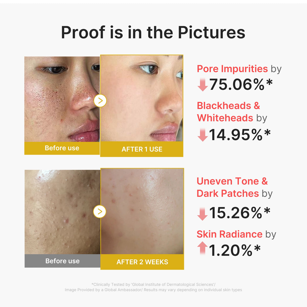 Kojic Acid Turmeric Peel Shot M2