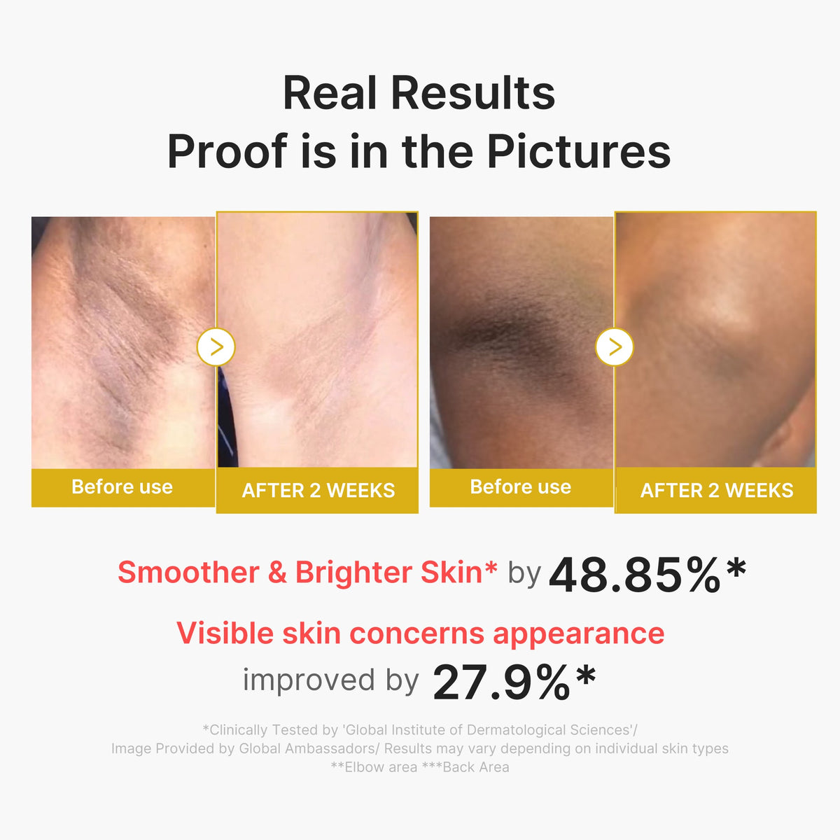 Kojic Acid Turmeric Body Peel Shot E9