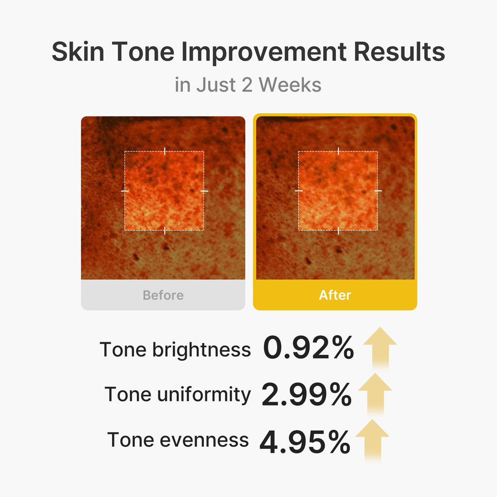 Kojic Acid Turmeric Vita Capsule Cream X4