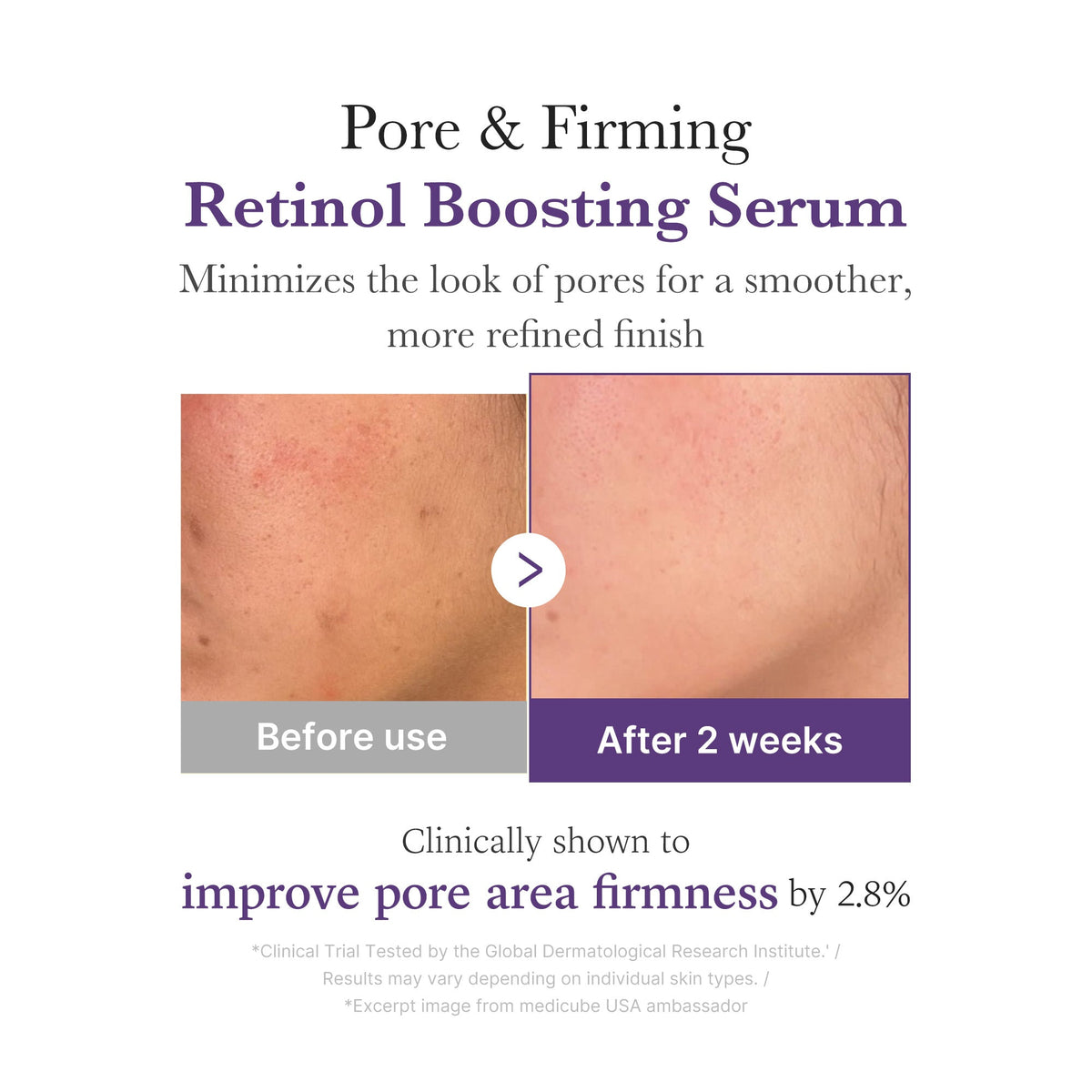 Retinol NMN Boosting Serum Z3
