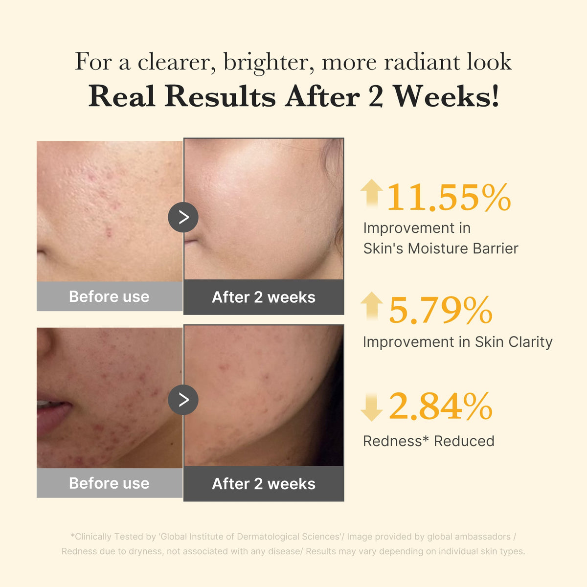 Kojic Acid Turmeric Capsule Serum B4