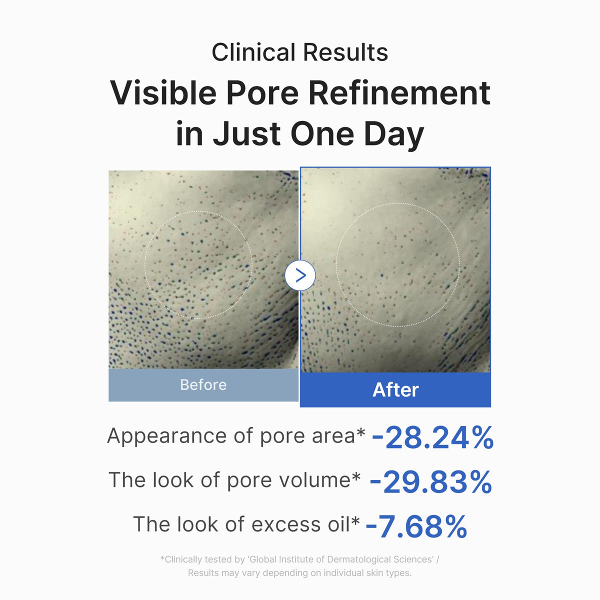 Zero Pore One-day Peptide Serum N3