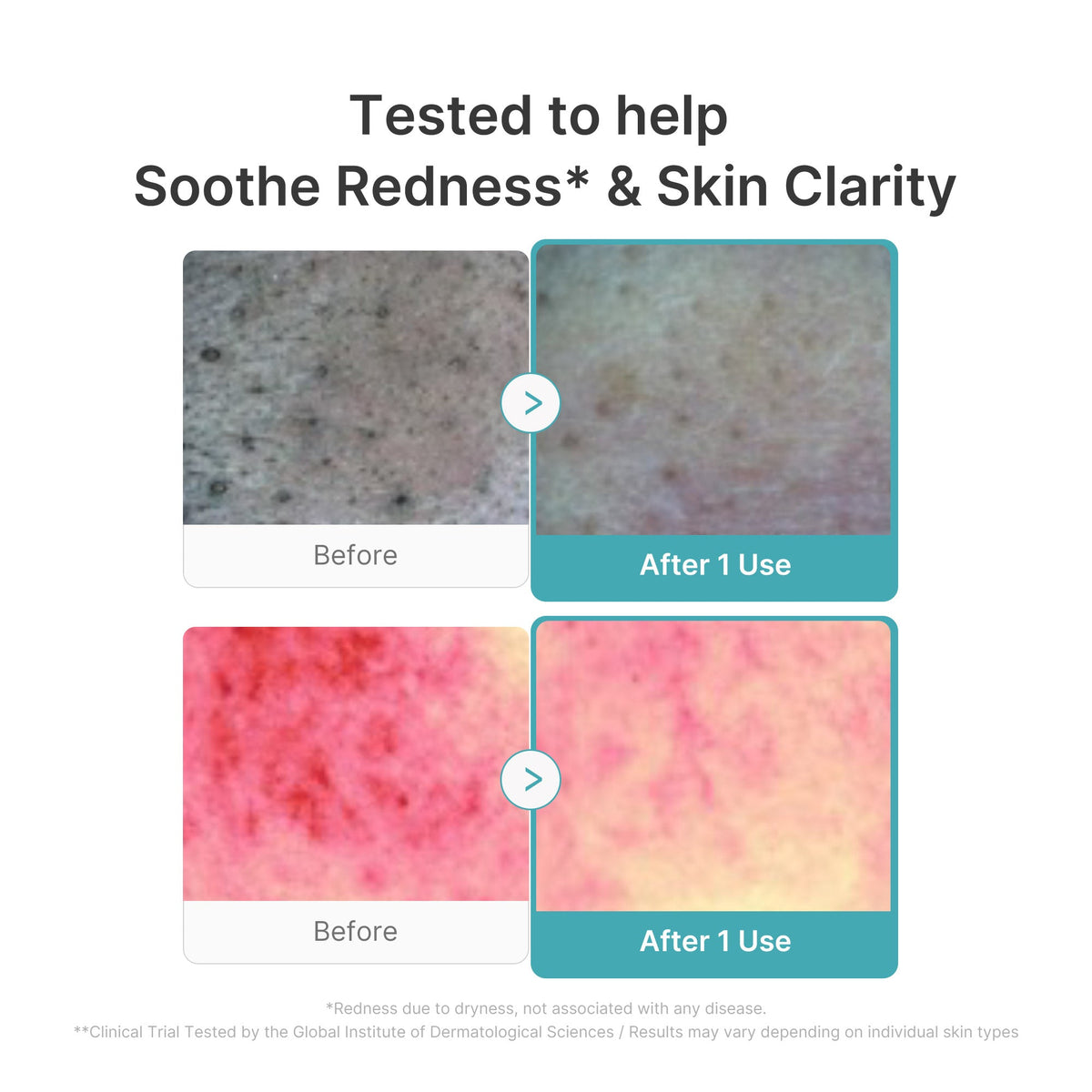 Azelaic Acid Capsule Foam Cleanser X9
