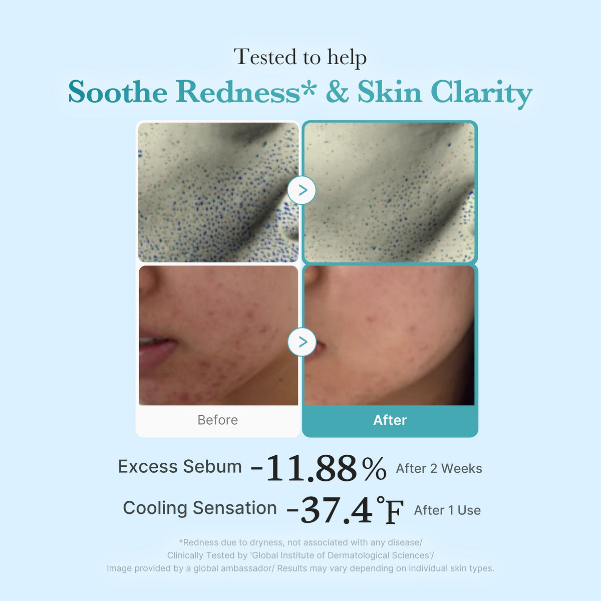 Azelaic Acid Niacinamide Clarifying Toner X5