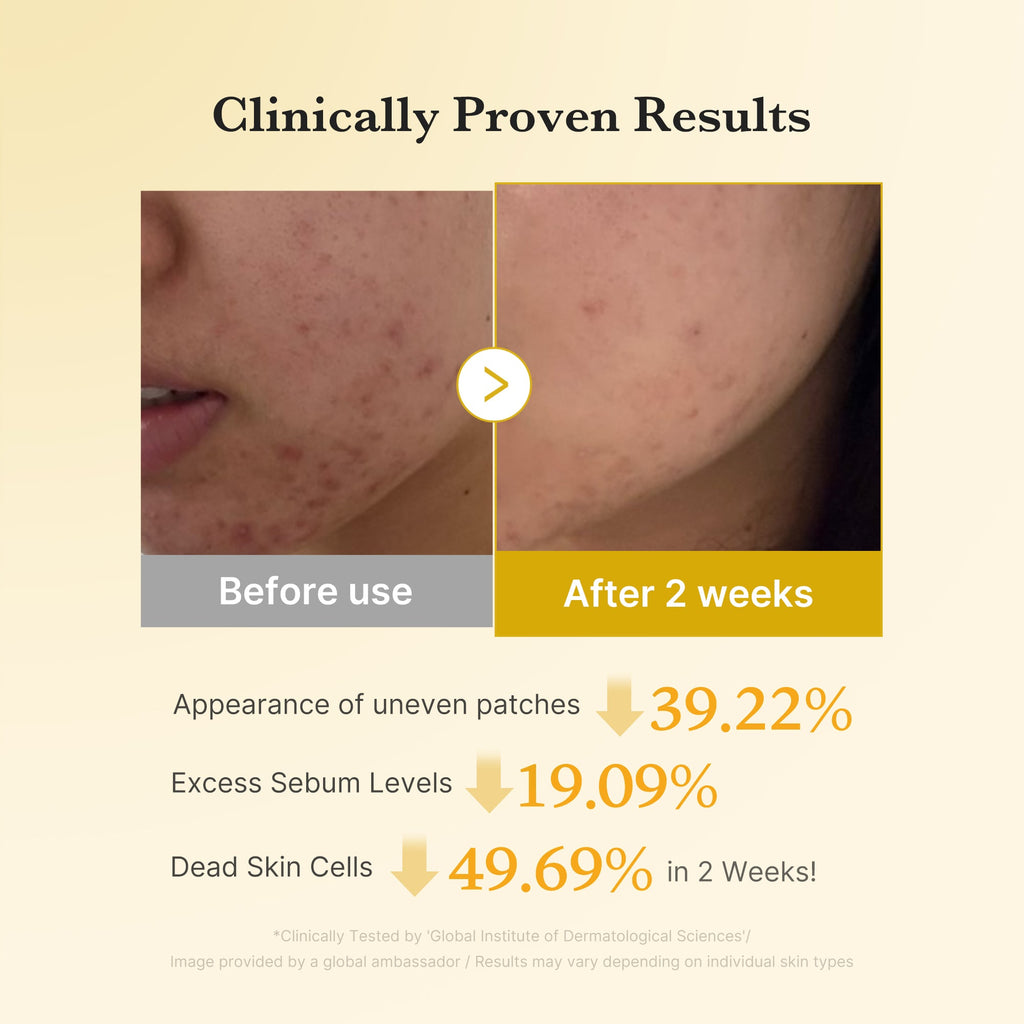 Kojic Acid Tumeric Toner Pad Q5
