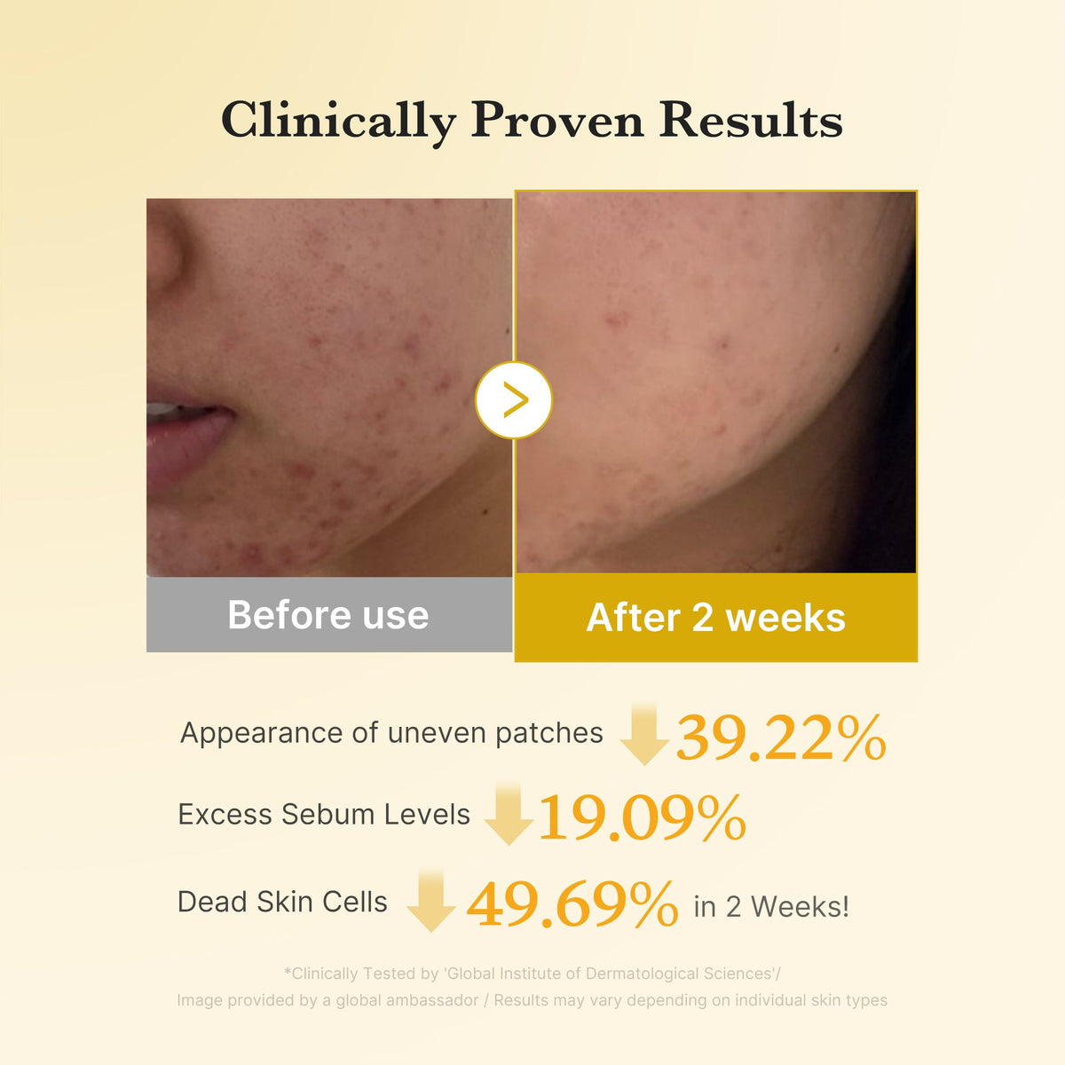 Kojic Acid Tumeric Toner Pad Q5