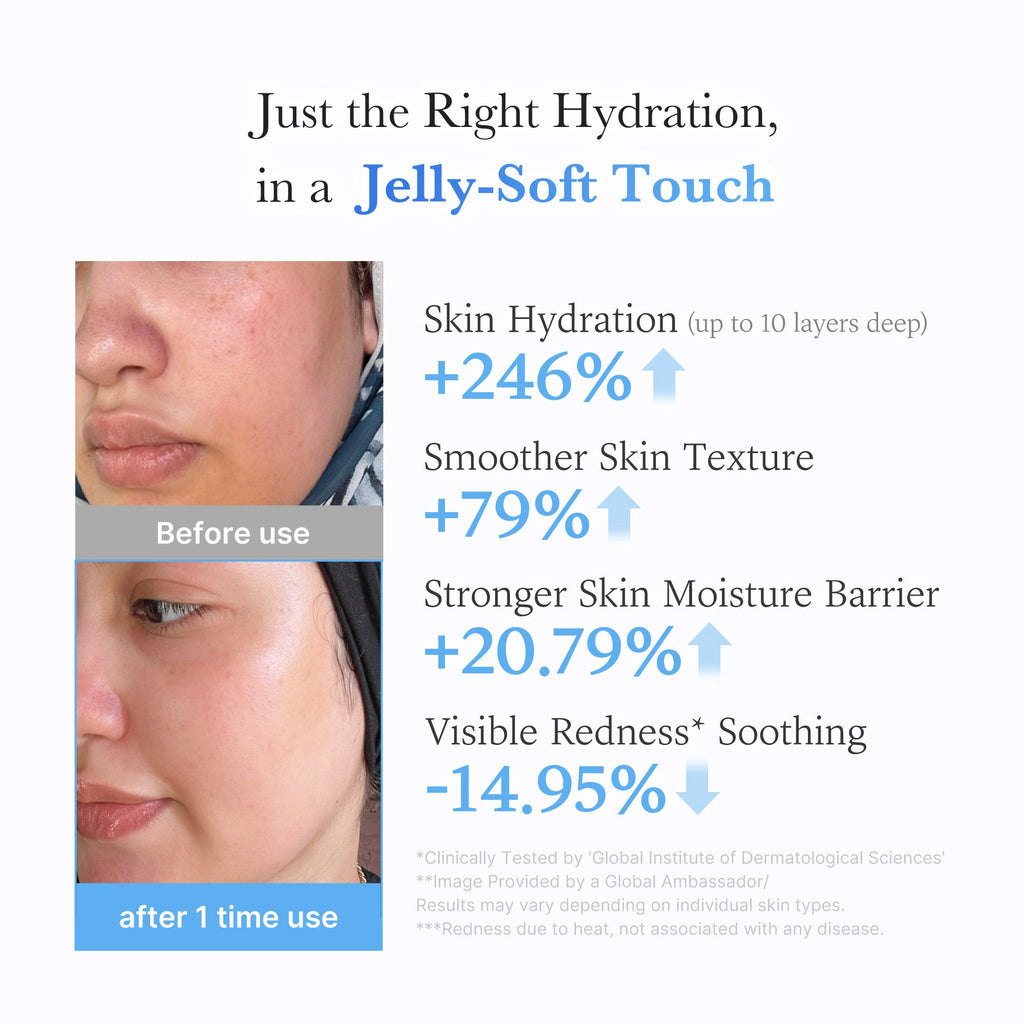 Hyaluronic Ceramide Moisturizing Jelly Cream P1