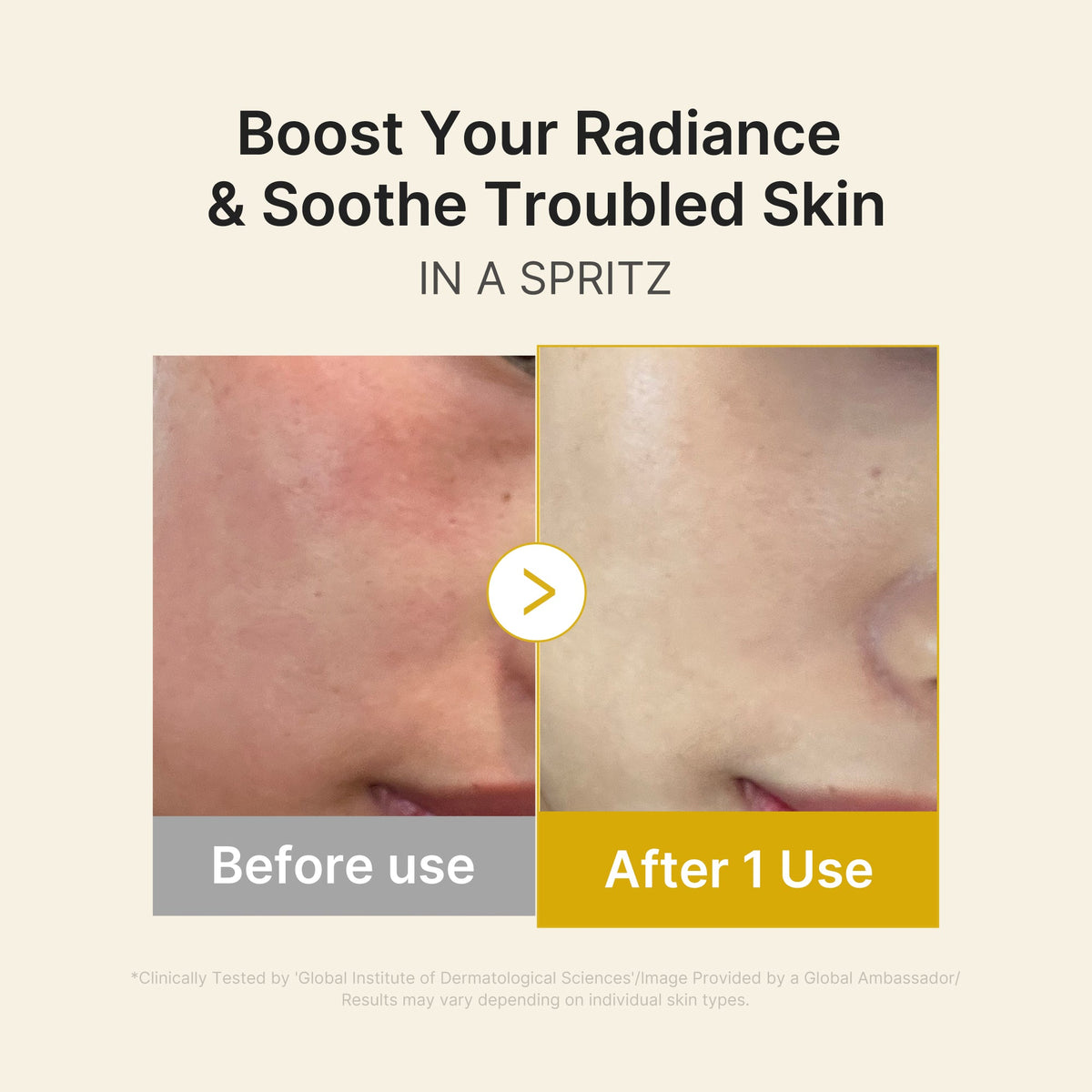 Kojic Acid Turmeric Vitamin Gold Jelly Mist Serum X3