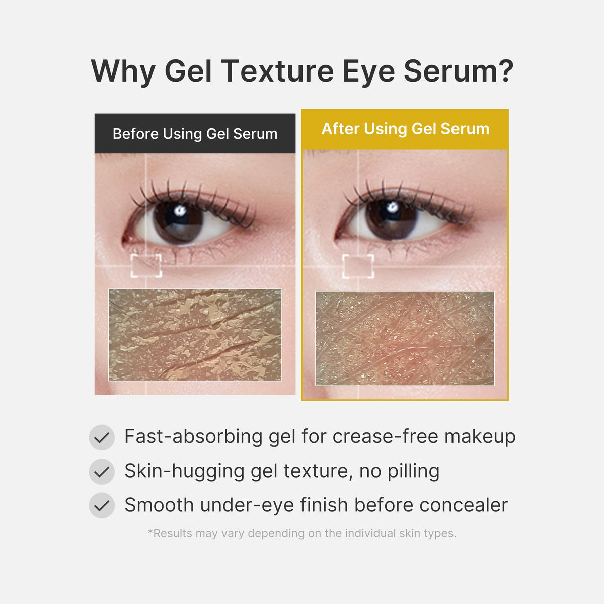 Kojic Acid Tumeric Eye Gel Serum Y4