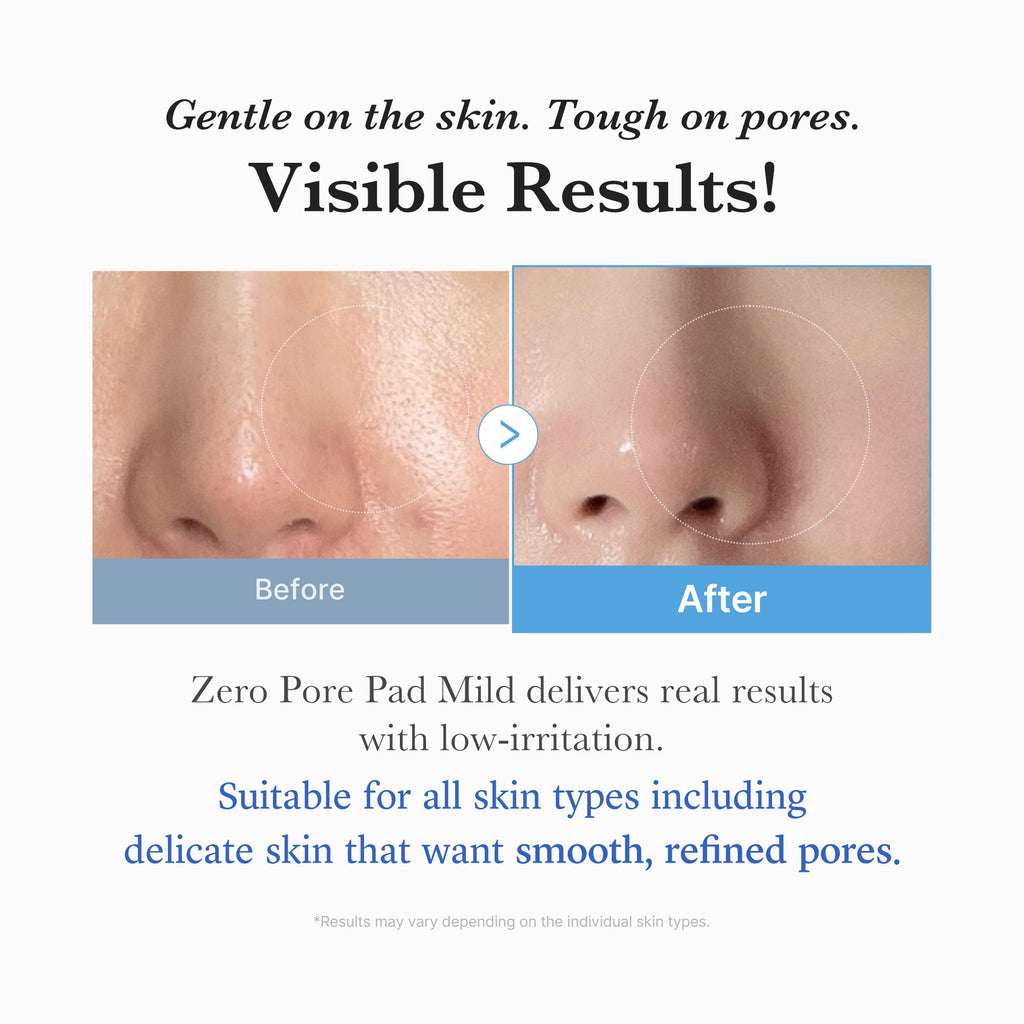 Zero Pore Madecassoside Pads (Mild) I4