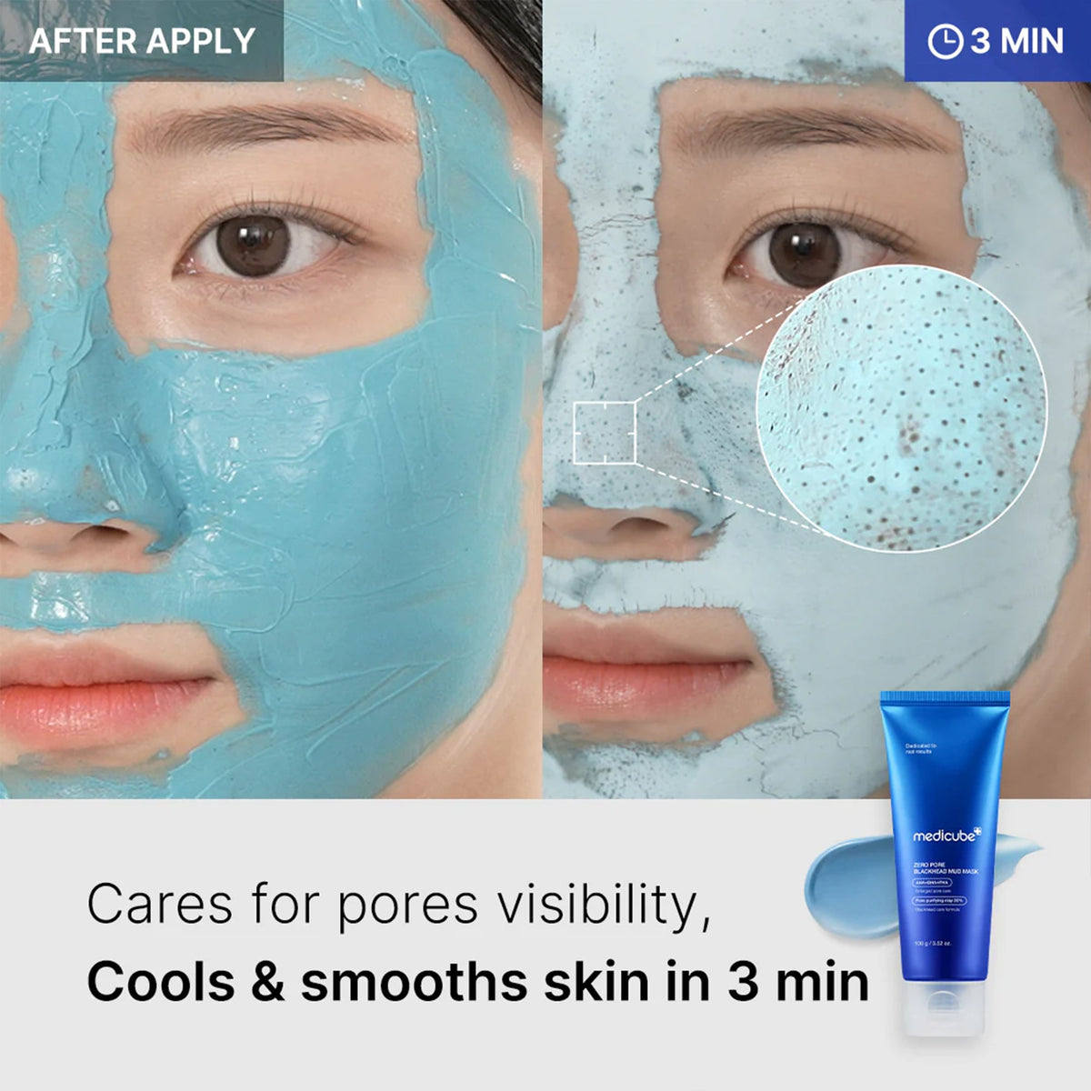 Zero Pore Blackhead Mud Mask V9
