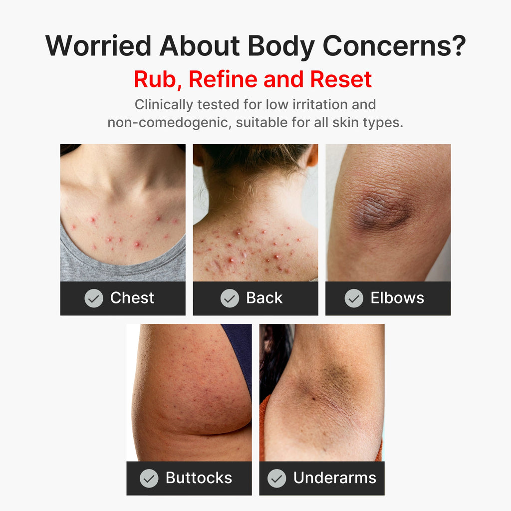 Kojic Acid Turmeric Body Peel Shot E9