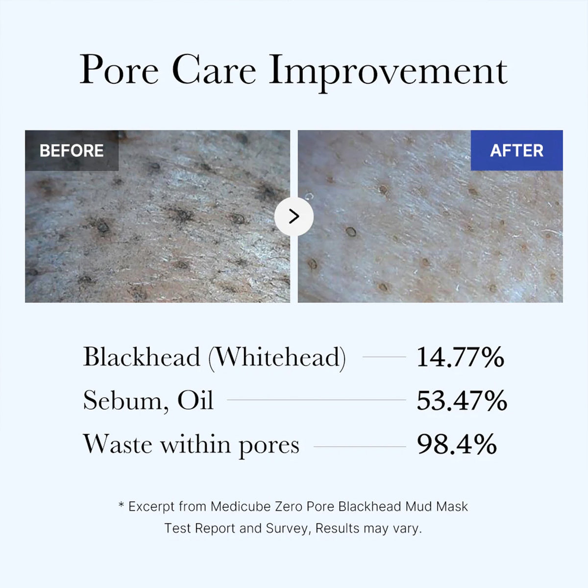 Zero Pore Blackhead Mud Mask V9
