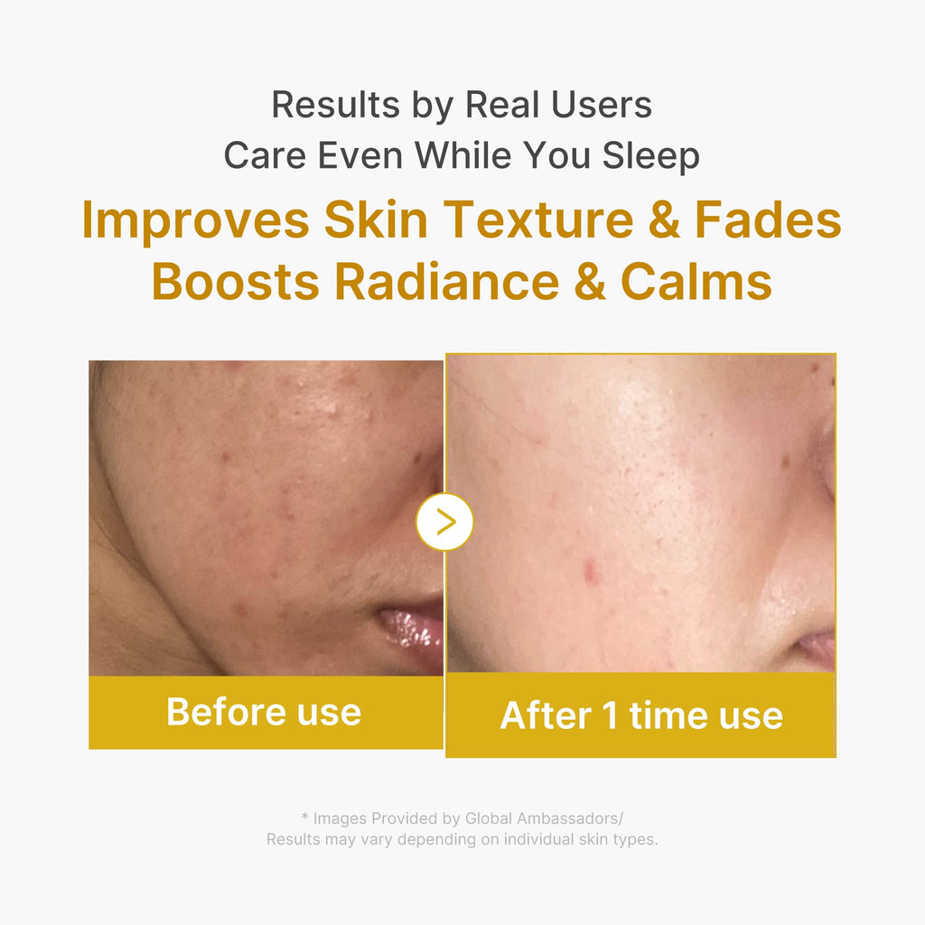 Kojic Acid Turmeric Overnight Wrapping Mask K9