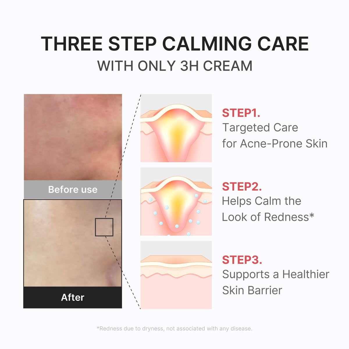 3H Daily Relief Cream J4