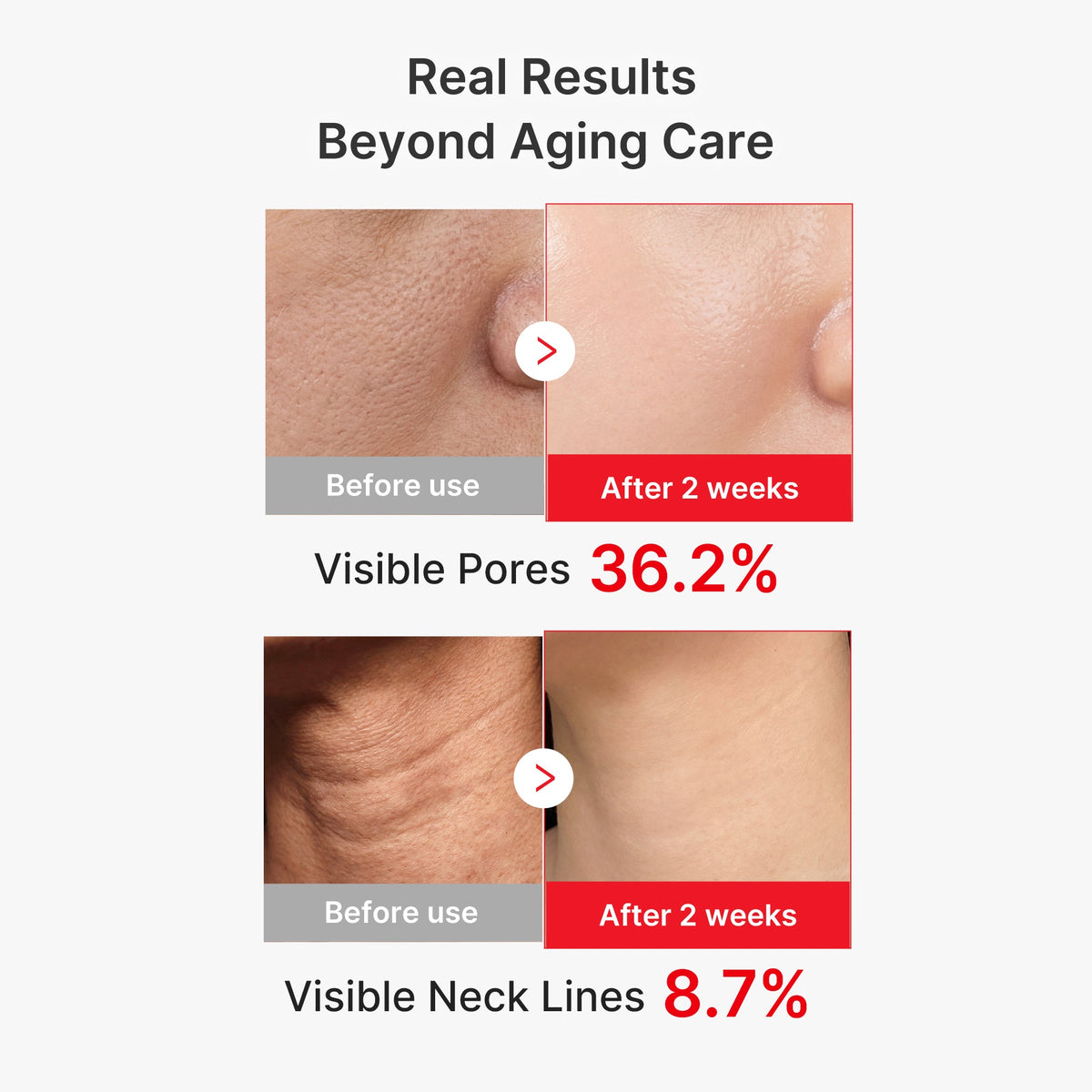 EGF NAD+ Firming Serum V9