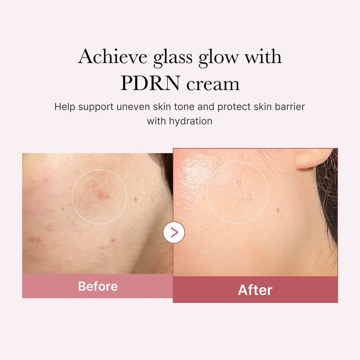 PDRN Pink Peptide Cream C4