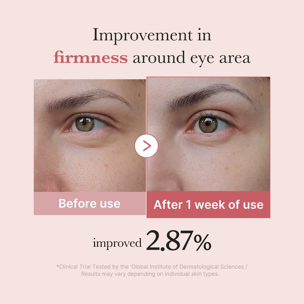 PDRN Pink Peptide Eye Cream H4