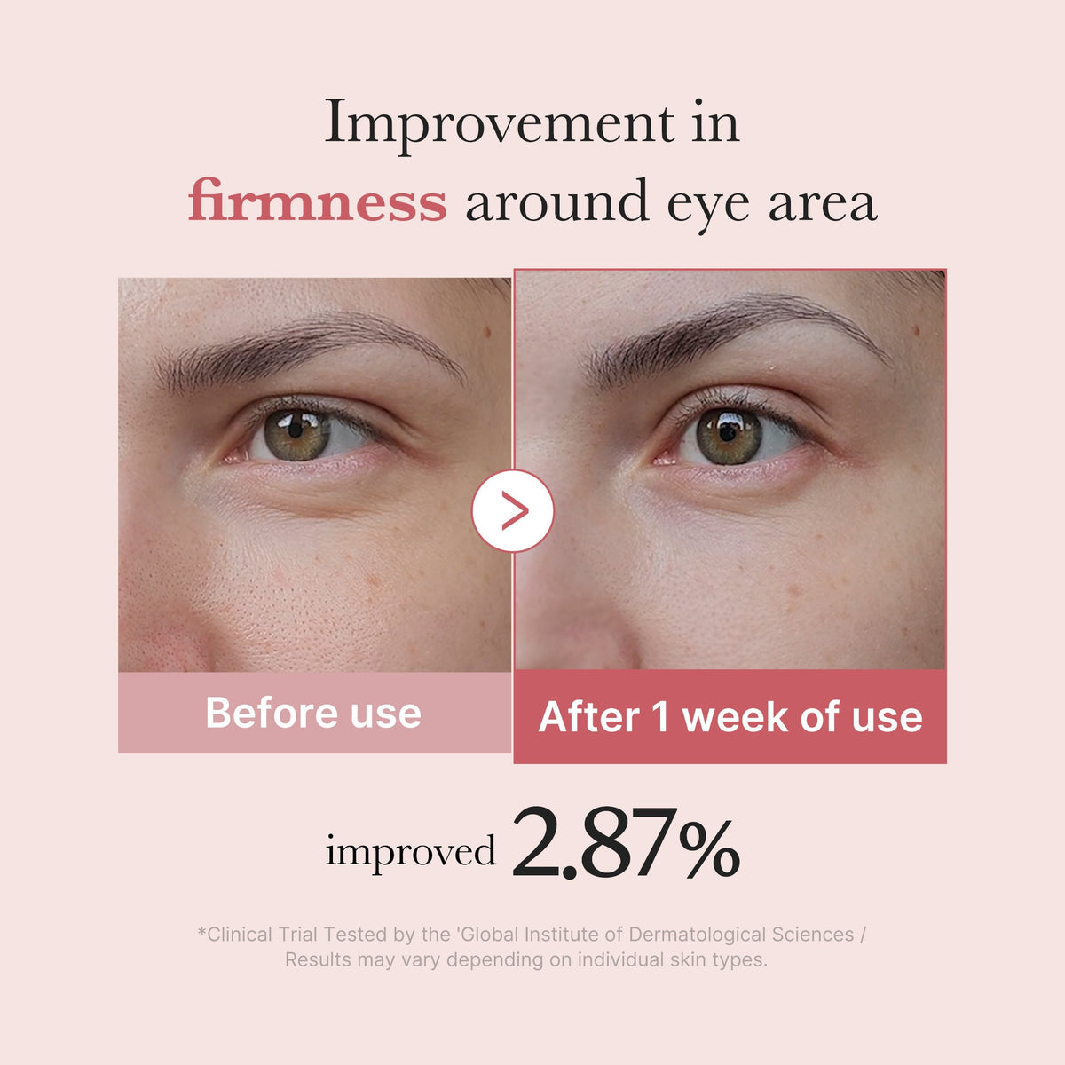 PDRN Pink Peptide Eye Cream H4