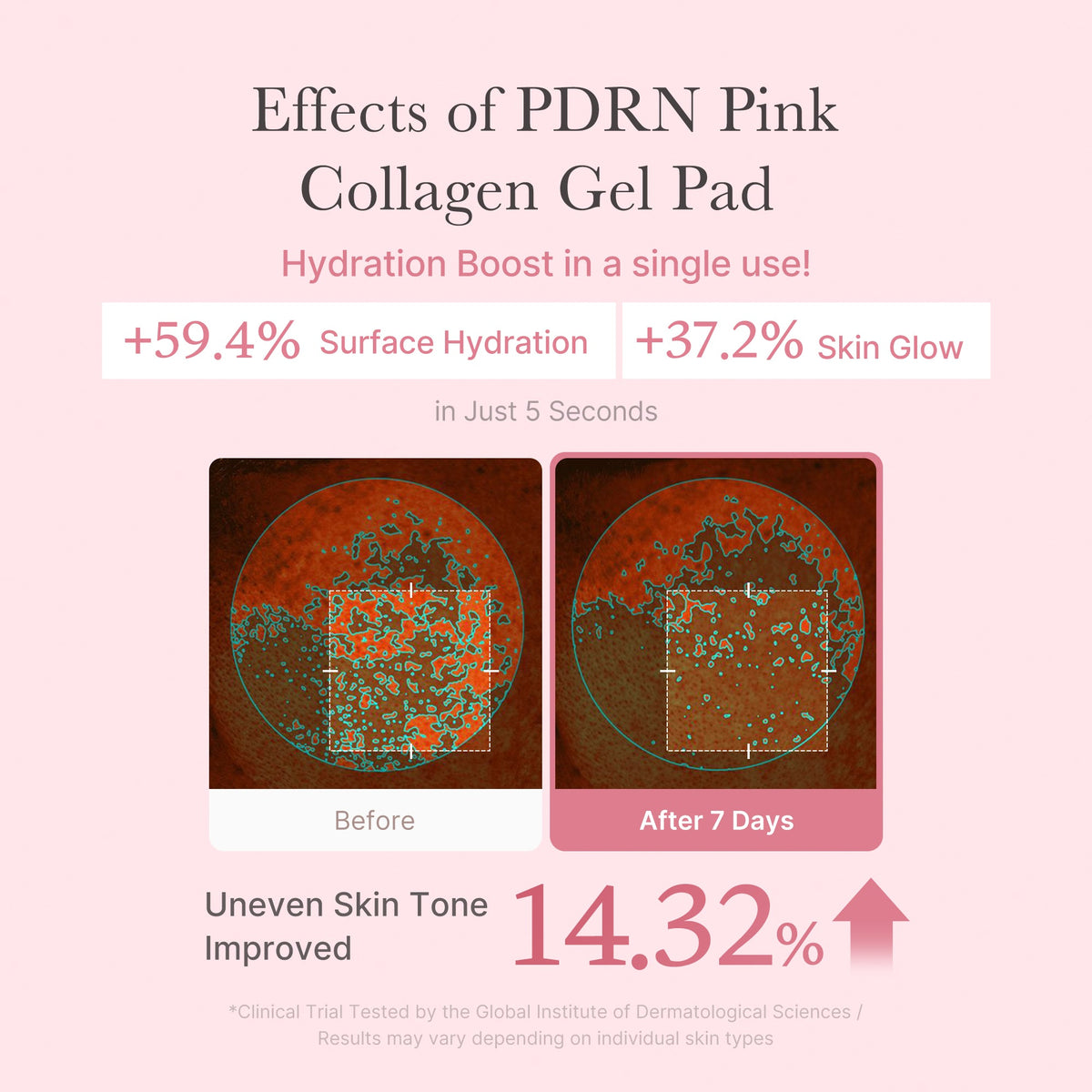 PDRN Pink Collagen Gel Toner Pad L9