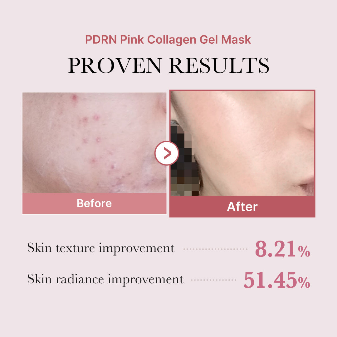 Salmon PDRN Pink Collagen Jelly Gel Mask I0