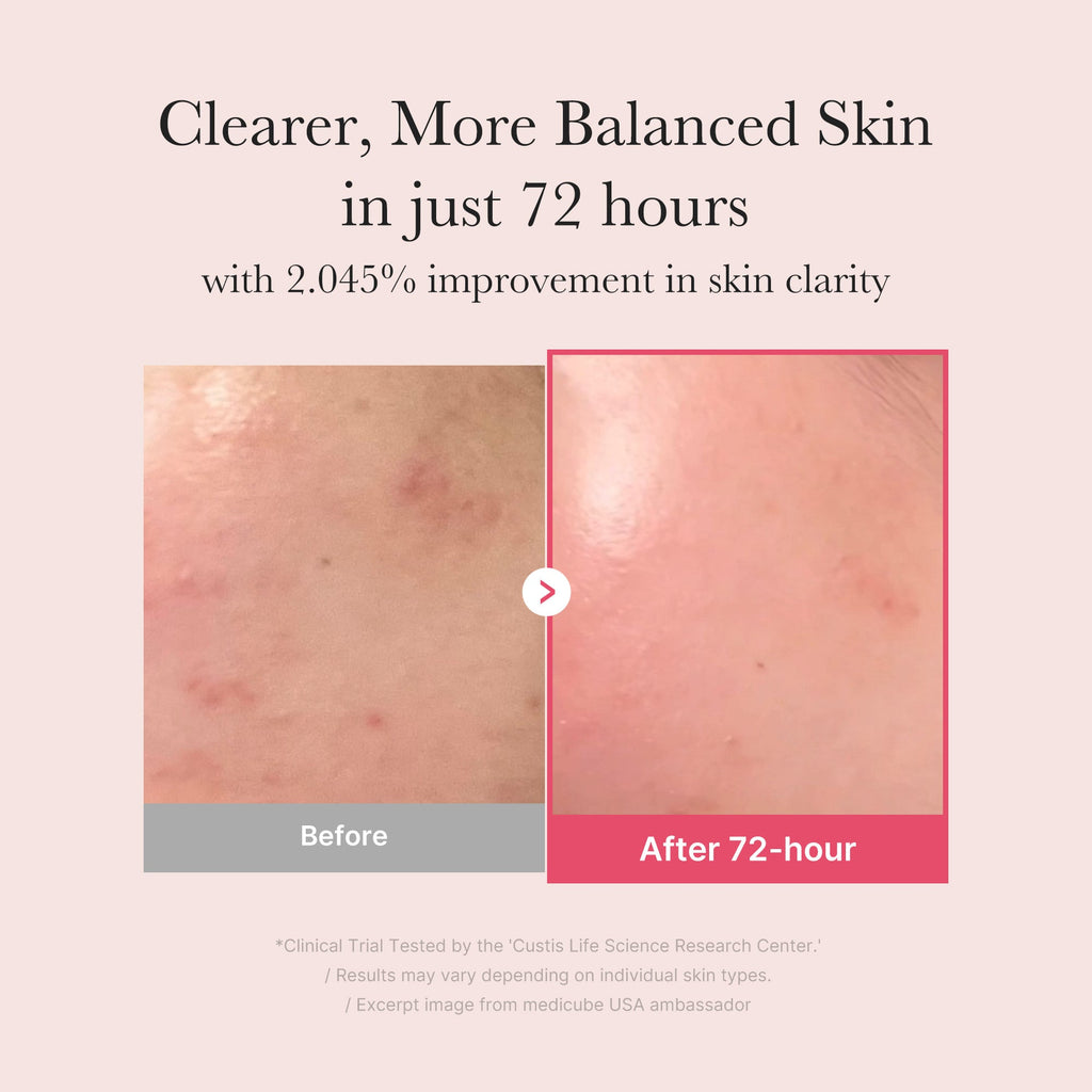 TXA Niacinamide Serum W0